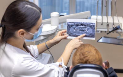 Why Some Ann Arbor Patients Choose Sedation for Endodontic Care